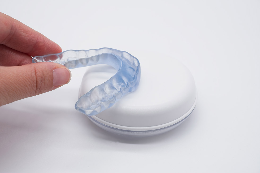 Custom dental nightguard for teeth grinding protection
